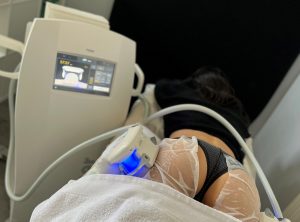 Séance de cryolipolyse